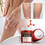Load image into Gallery viewer, (40% OFF) Varicose Care Treatment