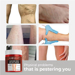 Load image into Gallery viewer, (40% OFF) Varicose Care Treatment