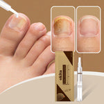 Load image into Gallery viewer, Fungus Relief Treatment Pen™